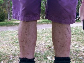 legs